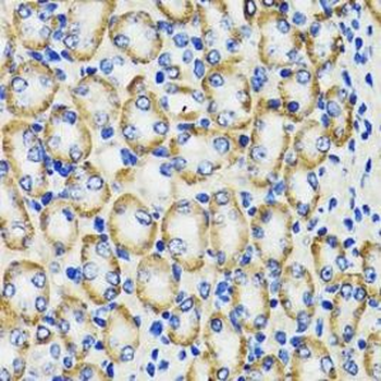 COMT Rabbit Polyclonal Antibody