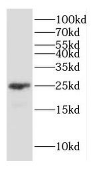 GJB2 Rabbit Polyclonal Antibody