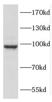 COPG2 Rabbit Polyclonal Antibody