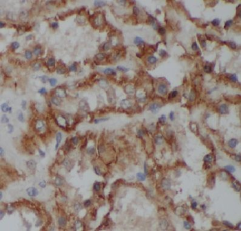 COPS3 Rabbit Polyclonal Antibody