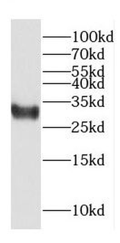 COPS7A Rabbit Polyclonal Antibody