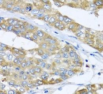 COQ7 Rabbit Polyclonal Antibody