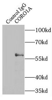 CORO1A Rabbit Polyclonal Antibody