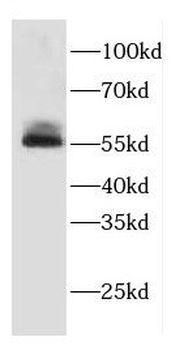 CORO1A Rabbit Polyclonal Antibody