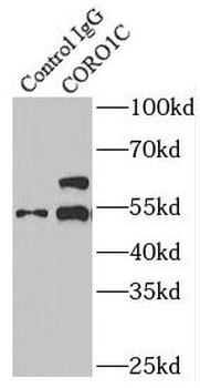 CORO1C Rabbit Polyclonal Antibody