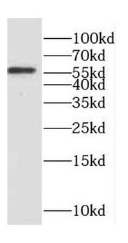 CORO1C Rabbit Polyclonal Antibody