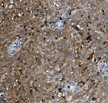 CORO1C Rabbit Polyclonal Antibody