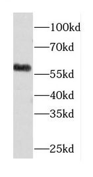 CORO6 Rabbit Polyclonal Antibody