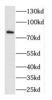 CTTN Rabbit Polyclonal Antibody