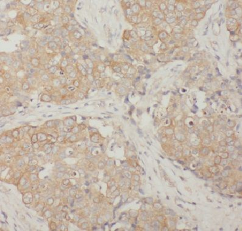 CTTN Rabbit Polyclonal Antibody