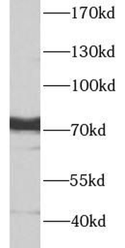 PTGS1 Rabbit Polyclonal Antibody