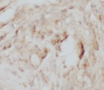 PTGS1 Rabbit Polyclonal Antibody