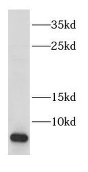 COX17 Rabbit Polyclonal Antibody