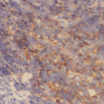 COX17 Rabbit Polyclonal Antibody