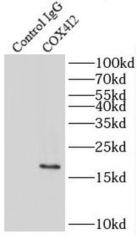 COX4I2 Rabbit Polyclonal Antibody
