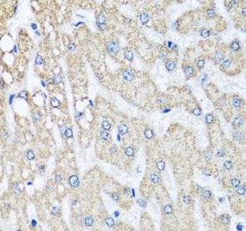 COX5B Rabbit Polyclonal Antibody