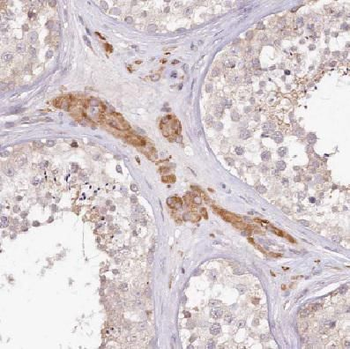 COX6B2 Rabbit Polyclonal Antibody