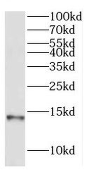 COX7A2L Rabbit Polyclonal Antibody