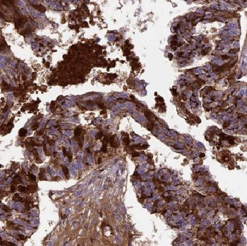 COX7A2L Rabbit Polyclonal Antibody