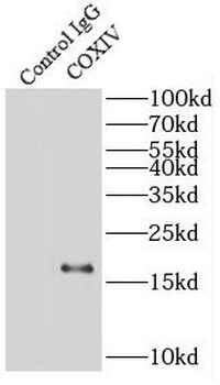 COX4I1 Rabbit Polyclonal Antibody