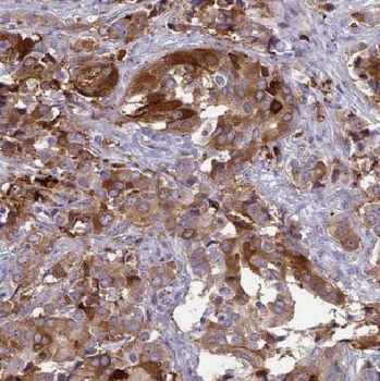 COX4I1 Rabbit Polyclonal Antibody