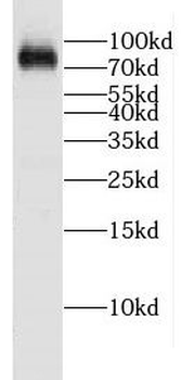 CPEB4 Rabbit Polyclonal Antibody