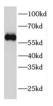 CPSF6 Rabbit Polyclonal Antibody
