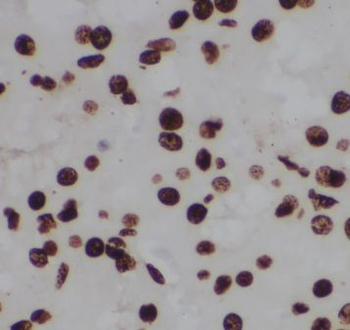 CPSF6 Rabbit Polyclonal Antibody