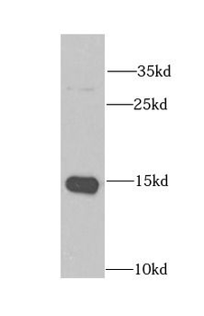 CRABP2 Rabbit Polyclonal Antibody