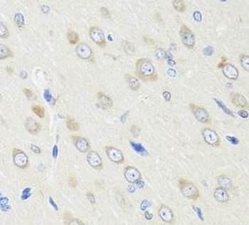 CRABP2 Rabbit Polyclonal Antibody