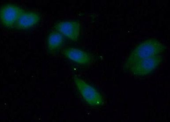 CRAT Rabbit Polyclonal Antibody
