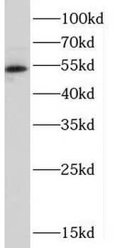 CRBN Rabbit Polyclonal Antibody