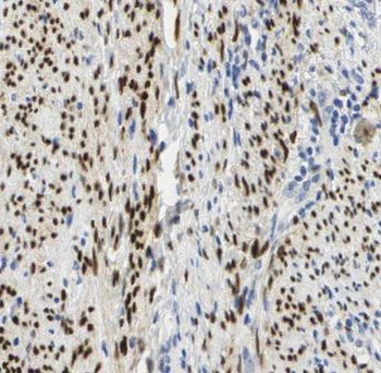 CRBN Rabbit Polyclonal Antibody