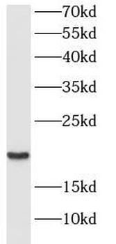 CRCP Rabbit Polyclonal Antibody