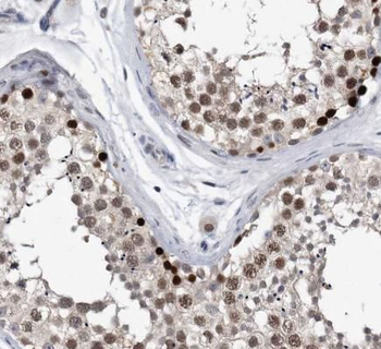CRCP Rabbit Polyclonal Antibody