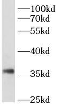 CREM Rabbit Polyclonal Antibody