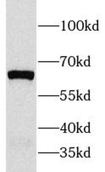CRHR1 Rabbit Polyclonal Antibody