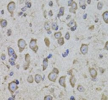 CRHR1 Rabbit Polyclonal Antibody