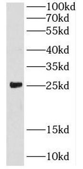 CRIP2 Rabbit Polyclonal Antibody