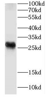 CRIP2 Rabbit Polyclonal Antibody