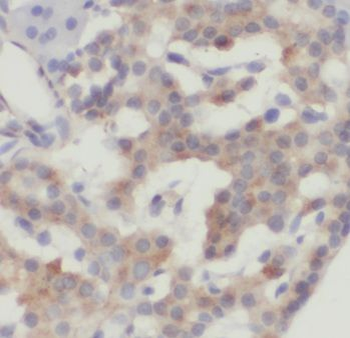 CRISP3 Rabbit Polyclonal Antibody