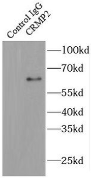 DPYSL2 Rabbit Polyclonal Antibody