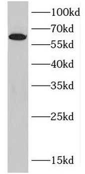 DPYSL2 Rabbit Polyclonal Antibody