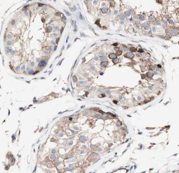 DPYSL2 Rabbit Polyclonal Antibody