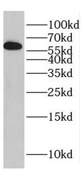 DPYSL5 Rabbit Polyclonal Antibody