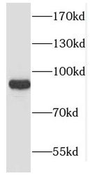 CSDE1 Rabbit Polyclonal Antibody