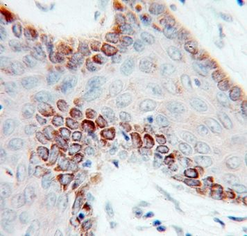 CSDE1 Rabbit Polyclonal Antibody