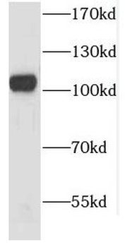 CSE1L Rabbit Polyclonal Antibody