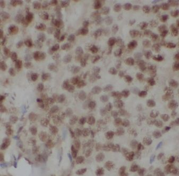 CSE1L Rabbit Polyclonal Antibody