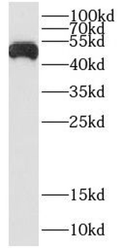 CSF2RA Rabbit Polyclonal Antibody